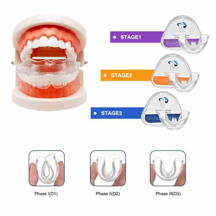 Orthodontic Dental Braces Smile Teeth Alignment Trainer